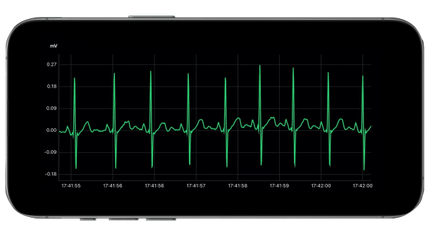High Quality Continuous ECG